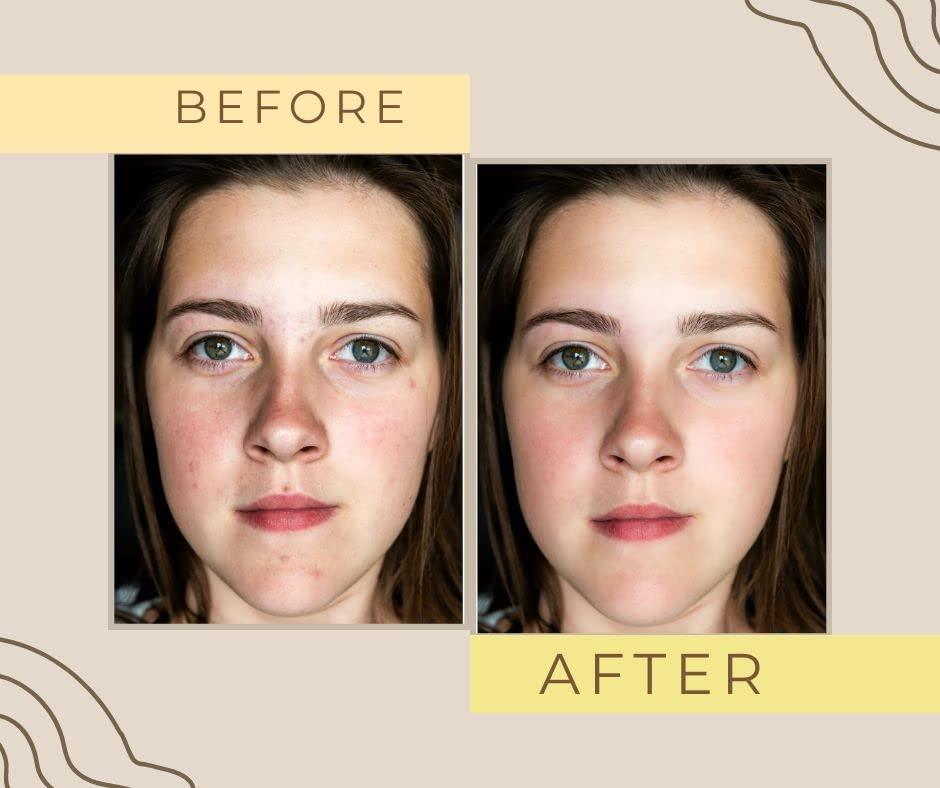 GlowRise Organics Skin Brightening Cream | OMICARE organics Skin glow and Whitening Cream