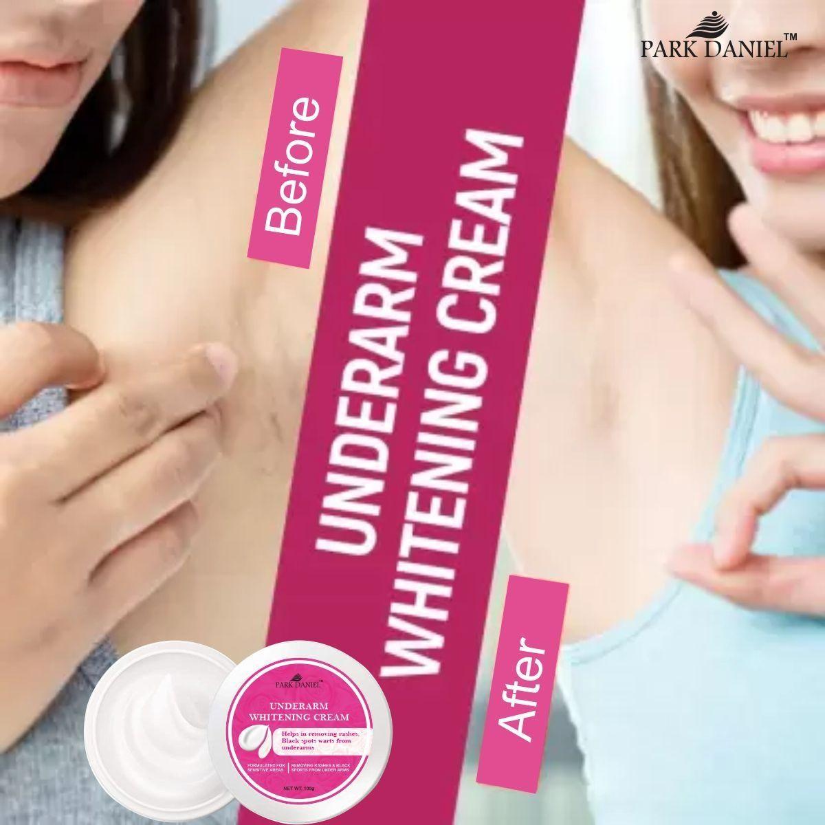 Park Daniel Underarms Darkness Lightening Cream Enriched with Kojic Acid, Nicinamide For Skin (100 grams) Roposo Clout