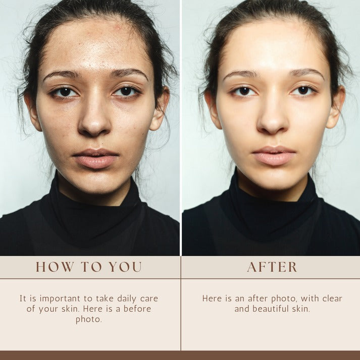 GlowRise Organics Skin Brightening Cream | OMICARE organics Skin glow and Whitening Cream