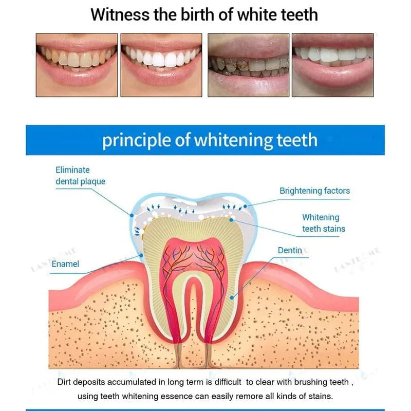 DENTIPEN Teeth Whitening Gel Pen