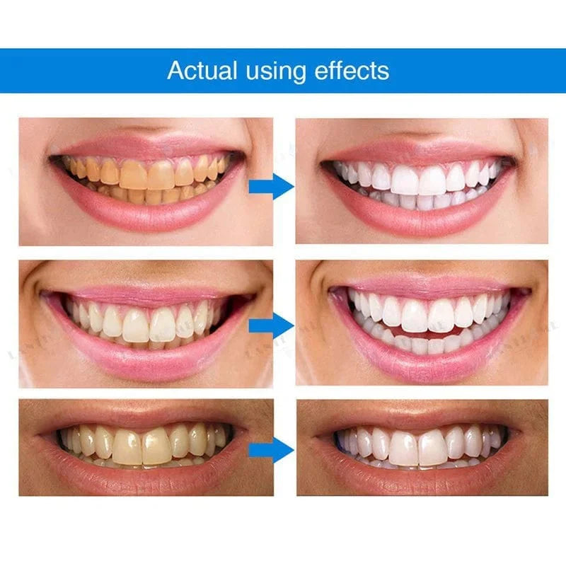 DENTIPEN Teeth Whitening Gel Pen