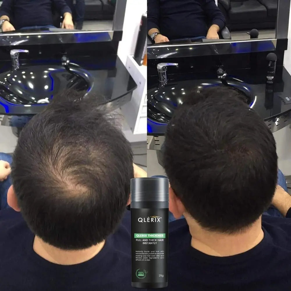 Get Thick Hair Instantly Roposo Clout