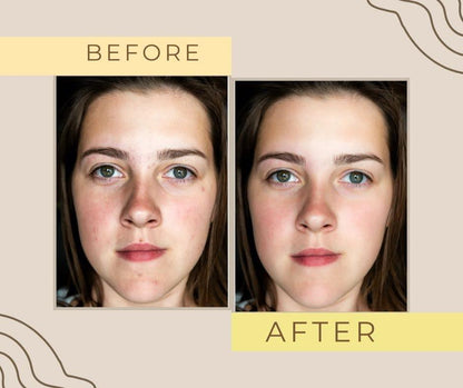 GlowRise Organics Skin Brightening Cream | OMICARE organics Skin glow and Whitening Cream