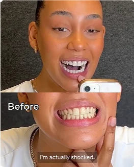 PURPLE TOOTHPASTE FOR TEETH WHITENING