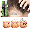 Ginger Plant Extract Anti-Hair Loss Hair Serum (Pack of 2) Roposo Clout