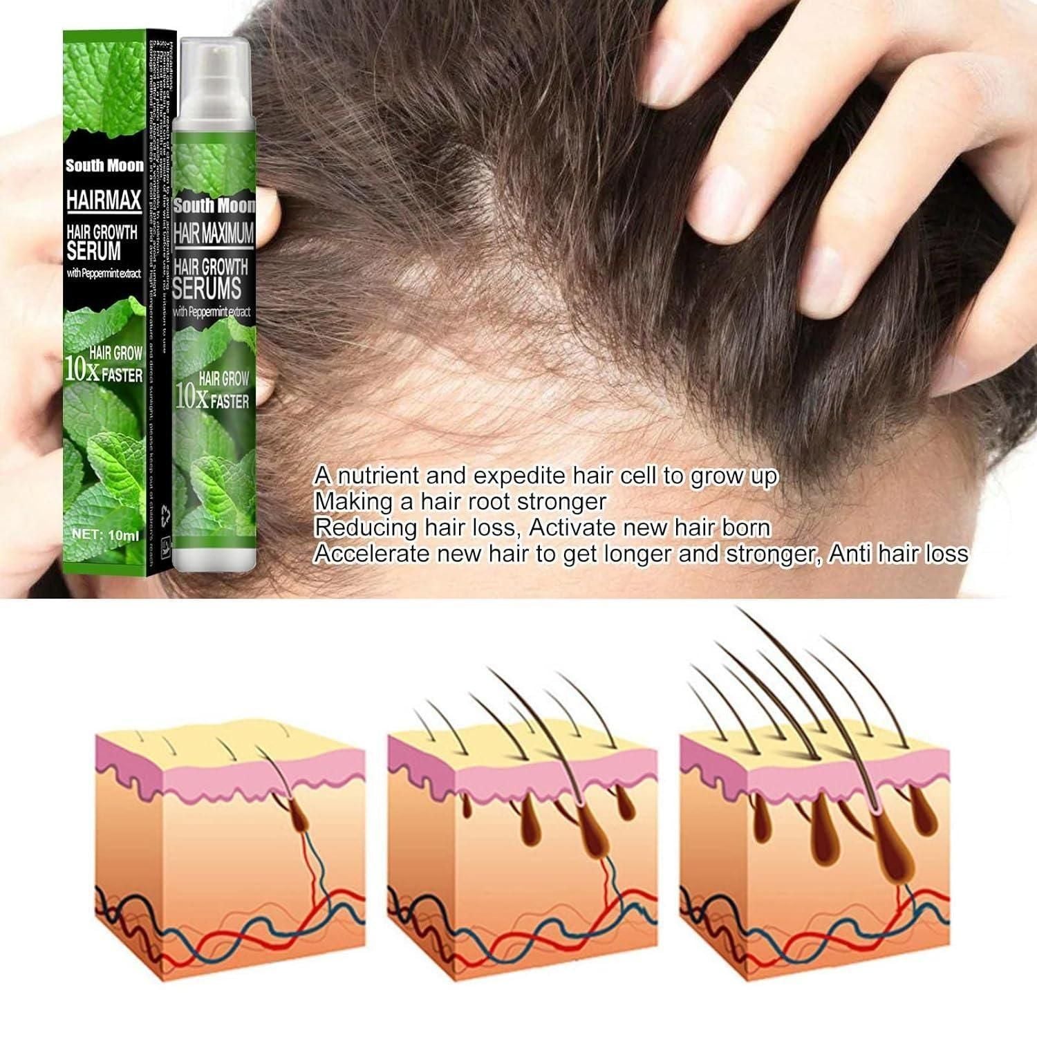 Ginger Plant Extract Anti-Hair Loss Hair Serum (Pack of 2) Roposo Clout