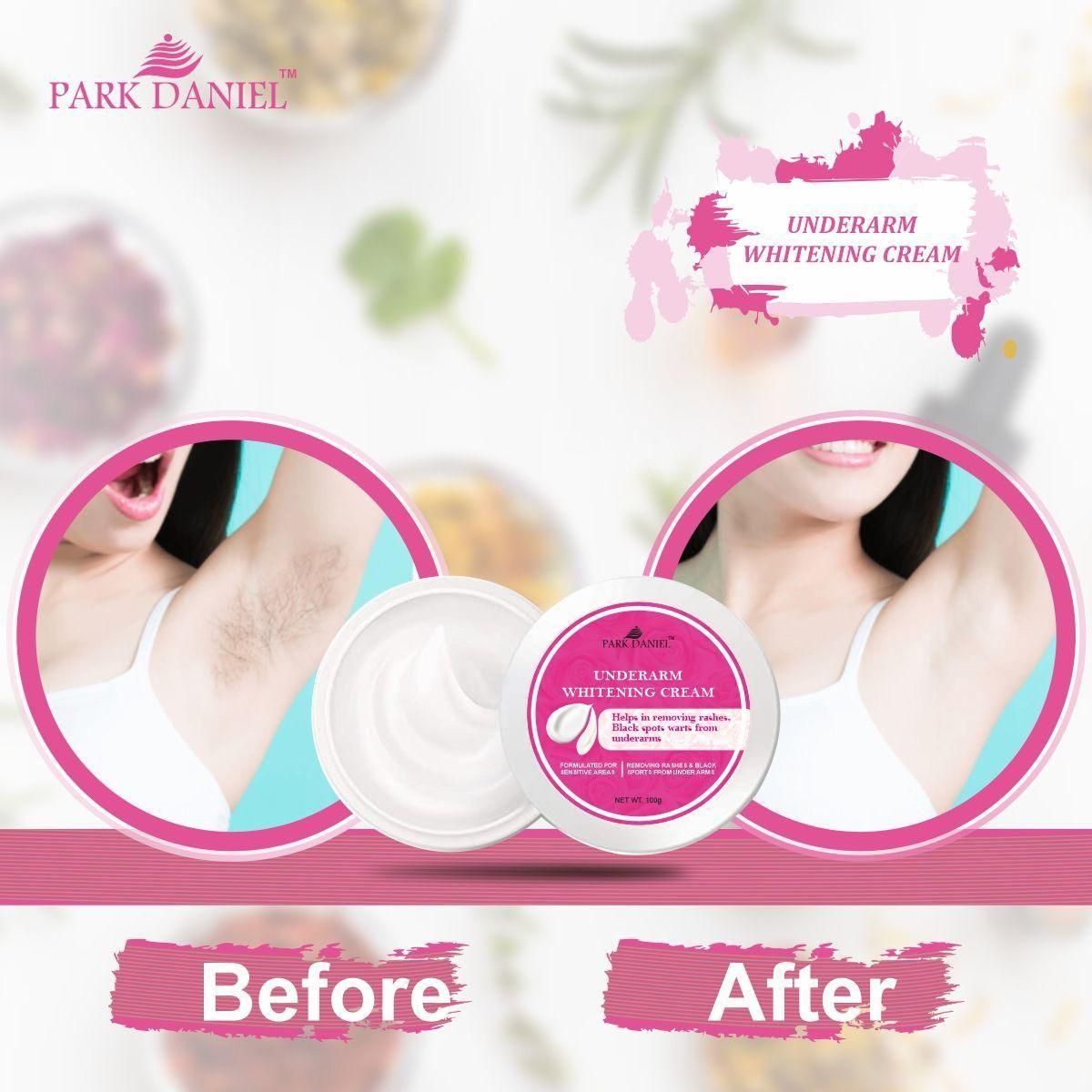 Park Daniel Underarms Darkness Lightening Cream Enriched with Kojic Acid, Nicinamide For Skin (100 grams) Roposo Clout