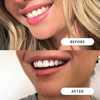DENTIPEN Teeth Whitening Gel Pen
